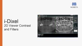 i-Dixel 2D Viewer - Adjusting Contrast and Filters