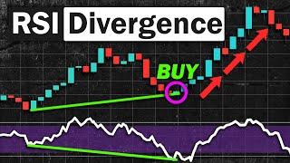 EASY RSI Divergence Strategy for Daytrading Forex & Stocks (High Winrate Strategy)