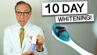 Hismile Purple Toothpaste for 10 Days - Dentist Review! #teethwhitening