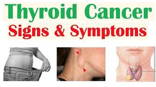 Thyroid Cancer Signs & Symptoms (& Why They Occur)