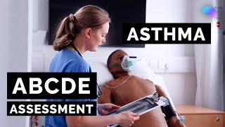 ABCDE Assessment | Asthma Exacerbation | Emergency Simulation | OSCE Guide | UKMLA | CPSA | PLAB