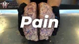 The Anatomy of Pain