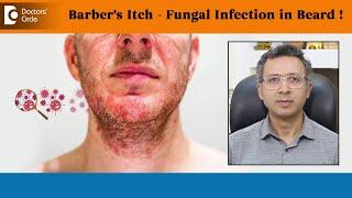 Barbers Itch Causes & Solution|Fungal Infection in Beard|Tinea Barbae-Dr.Nischal K C|Doctors' Circle