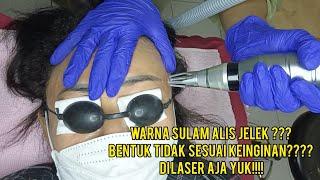 Laser Sulam Alis Part 1|| Warna sulam alis seperti tato di laser aja guys biar lebih bagus