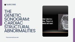 The Genetic Sonogram: Cardiac Structural Abnormalities