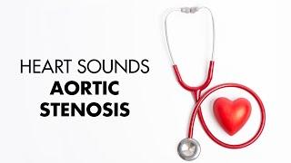 Aortic Stenosis - Heart Sounds - MEDZCOOL