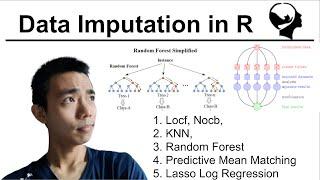 Dealing with Missing Data in R