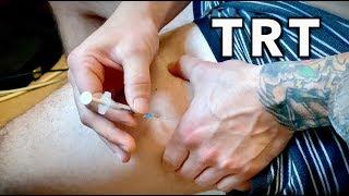 MY NEW FAVORITE WAY TO INJECT (Testosterone Replacement Therapy / Dr. Prescribed TRT)