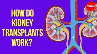 How does kidney transplant surgery work? - Alexander H. Toledo