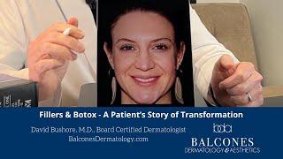 Fillers & Botox--A Patient Story of Transformation | David Bushore, MD, FAAD | Ph: 512-459-4869