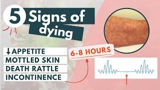 How to recognize a dying patient? | 5 signs of approaching death