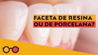 Qual a melhor Lente de contato dental? Facetas de resina ou porcelana? - Plantão de Dúvidas