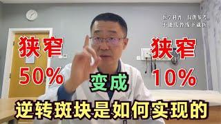 心脏冠状动脉斑块，狭窄从50%降到10%，怎么做到的？如何逆转斑块