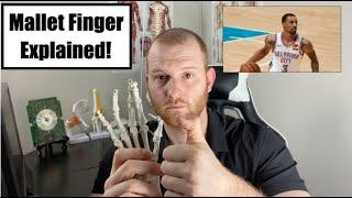 George Hill Injury Explained! - George Hill Mallet Finger