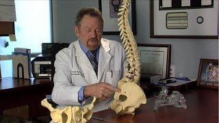 Sacroiliac Joint Fusion with The iFuse Implant - Dr. Duffner
