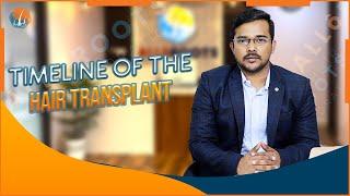 Timeline of the Hair Transplant | Dr Alok Sahoo Explained in Detail | Alloroots