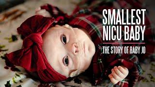 Smallest NICU Baby - The Story of Baby Jo