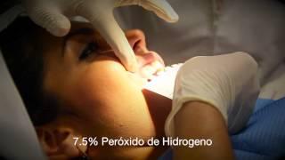 Zeyco: Blanqueamiento Dental