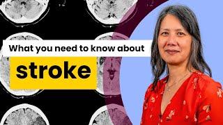 What you need to know about stroke