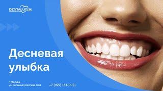  Десневая улыбка. Как исправить десневую улыбку?