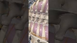 Using Augmented Reality in 3D4 Medical Complete Anatomy App to review Paravertebral Blocks Anatomy