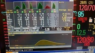 Cardiac output (the longer version)