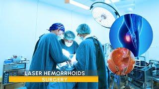 Laser Hemorrhoids Surgery - Turquie santé