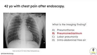 High Yield Radiology for USMLE Step 1: Adult Respiratory Part 1