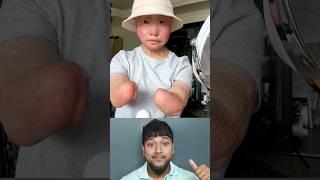 Love Is Gone | Disable Armless Girl#shorts#ytshorts#viral