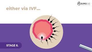 The IVF/ICSI process