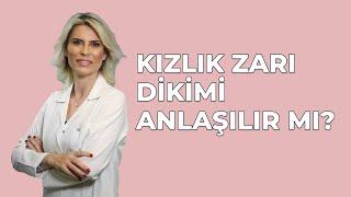 Kızlık Zarı Dikimi Anlaşılır Mı?  - Jin. Op. Dr. Burcu K. Arslan