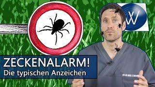 Zecken Alarm! Achten Sie auf diese typischen Alarmzeichen nach Zeckenbiss! Hautrötung, Wanderröte...