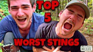 TOP 5 WORST STINGS! RANKING My Most Painful Sting Tests