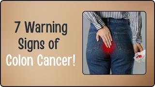 Silent Killer: The 7 Warning Signs of Colon Cancer You Must Not Ignore