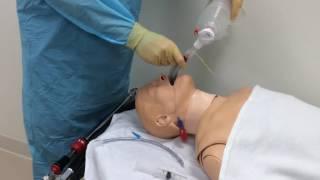 Air-Q supraglottic airway insertion