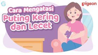 Cara Mengatasi Puting Kering dan Lecet