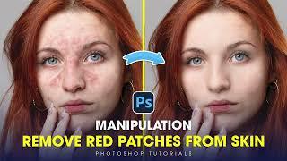 Photoshop Tutorials 2024 - How to remove red patches on skin most accurately