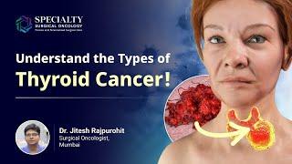 Different Types of Thyroid Cancer| Explore the Most Common Type | Dr Jitesh Rajpurohit, SSO