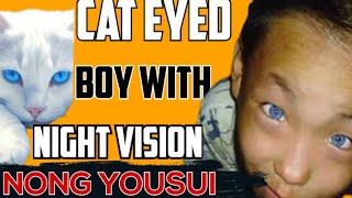 China's Cat-Eyed Boy: Unveiling the Mystery of Night Vision Due to Genetic Mutation /sonnycwtv