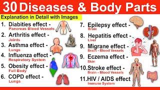 Diseases GK | Human Disease GK | Diseases and Affected Body parts | Human Health and Diseases #neet