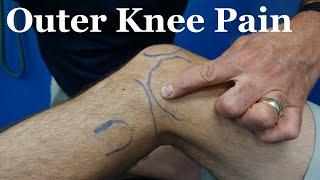 Most Common Causes of Lateral Knee Pain