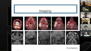 Topic 1 Introduction and overview of H&N Contouring (Part 1)