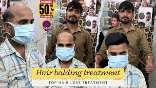 Hairline loss treatment | Hair wig | Hair patch | wigs | Hair treatment for hair loss | 9643765000