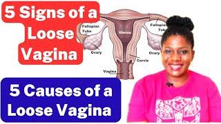 5 Signs of a Loose Vagina / 5 Causes of a Loose Vagina