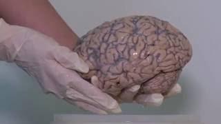 Крупнейшая в мире коллекция мозгов
