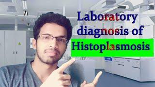 Laboratory diagnosis of Histoplasmosis | Histoplasma capsulatum|dimorphic fungi