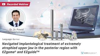 Webinar:Navigated implantological treatment of extremely atrophied upper jaw in the posterior region