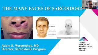 The Many Faces of Sarcoidosis