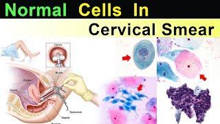 Normal Cells in Cervical Smear  ( Clear Explain )