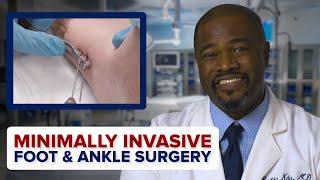 Minimally Invasive Foot & Ankle Surgery | Penn Orthopaedics